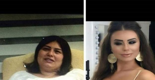 6 ayda 59 kiloqram arıqladı -  İndi onu heç kim tanımır - FOTO